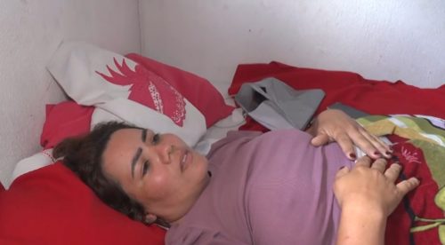 Luana vai precisar ficar acamada por três meses após acidente na passarela em Parnamirim — Foto: Reprodução/Inter TV Cabugi