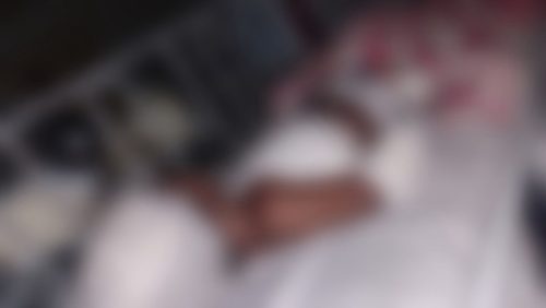 Criança de 2 anos sofreu queimaduras profundas, segundo CTQ do Walfredo Gurgel — Foto: Cedida